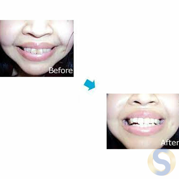 Teeth peeling sponge - 画像 (2)